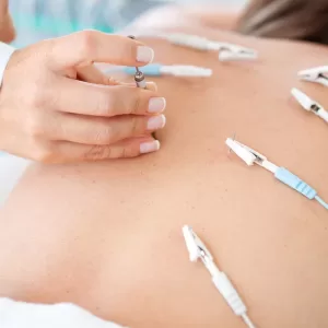 electroacupuncture on a patient